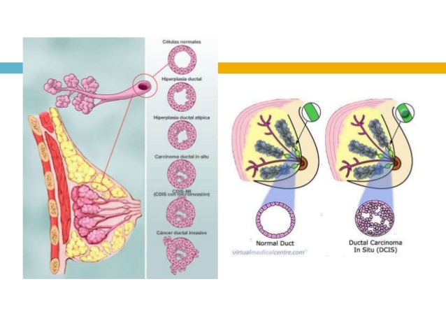 doctores, cirujano, cirujanos, doctoras, cirujano gastrointestinal, cirujano gastrointestinal y laparoscopia, cirujano general, laparoscopía, cirugia, hernias, hernias inguinales, vesícula, vesicula, hemorroides, fisuras anales, apendicectomía, apendicectomia, biopsias, cancer de mama, mastectomia, cáncer de mama, mastectomía, cirugía Conservadora de mama, cirugía Conservadora de mama, ganglio Centinela, seguimiento en cancer de mama, seguimiento en cáncer de mama, check up de la mujer, escleroterapia, úlceras, ulceras, heridas, apendicitis, piedras en vesicula, piedras en riñones, lipomas, doctores slp, cirujano slp, cirujanos slp, doctoras slp, cirujano gastrointestinal slp, cirujano gastrointestinal y laparoscopia slp, cirujano general slp, laparoscopía slp, cirugia slp, hernias slp, hernias inguinales slp, vesícula slp, vesicula slp, hemorroides slp, fisuras anales slp, apendicectomía slp, apendicectomia slp, biopsias slp, cancer de mama slp, mastectomia slp, cáncer de mama slp, mastectomía slp, cirugía Conservadora de mama slp, cirugía Conservadora de mama slp, ganglio Centinela slp, seguimiento en cancer de mama slp, seguimiento en cáncer de mama slp, check up de la mujer slp, escleroterapia slp, úlceras slp, ulceras slp, heridas slp, apendicitis slp, piedras en vesicula slp, piedras en riñones slp, lipomas slp, doctores san luis potosi, cirujano san luis potosi, cirujanos san luis potosi, doctoras san luis potosi, cirujano gastrointestinal san luis potosi, cirujano gastrointestinal y laparoscopia san luis potosi, cirujano general san luis potosi, laparoscopía san luis potosi, cirugia san luis potosi, hernias san luis potosi, hernias inguinales san luis potosi, vesícula san luis potosi, vesicula san luis potosi, hemorroides san luis potosi, fisuras anales san luis potosi, apendicectomía san luis potosi, apendicectomia san luis potosi, biopsias san luis potosi, cancer de mama san luis potosi, mastectomia san luis potosi, cáncer de mama san luis potosi, mastectomía san luis potosi, cirugía Conservadora de mama san luis potosi, cirugía Conservadora de mama san luis potosi, ganglio Centinela san luis potosi, seguimiento en cancer de mama san luis potosi, seguimiento en cáncer de mama san luis potosi, check up de la mujer san luis potosi, escleroterapia san luis potosi, úlceras san luis potosi, ulceras san luis potosi, heridas san luis potosi, apendicitis san luis potosi, piedras en vesicula san luis potosi, piedras en riñones san luis potosi, lipomas san luis potosi, doctores san luis potosí, cirujano san luis potosí, cirujanos san luis potosí, doctoras san luis potosí, cirujano gastrointestinal san luis potosí, cirujano gastrointestinal y laparoscopia san luis potosí, cirujano general san luis potosí, laparoscopía san luis potosí, cirugia, hernias san luis potosí, hernias inguinales san luis potosí, vesícula san luis potosí, vesicula san luis potosí, hemorroides san luis potosí, fisuras anales san luis potosí, apendicectomía san luis potosí, apendicectomia san luis potosí, biopsias san luis potosí, cancer de mama san luis potosí, mastectomia san luis potosí, cáncer de mama san luis potosí, mastectomía san luis potosí, cirugía Conservadora de mama san luis potosí, cirugía Conservadora de mama san luis potosí, ganglio Centinela san luis potosí, seguimiento en cancer de mama san luis potosí, seguimiento en cáncer de mama san luis potosí, check up de la mujer san luis potosí, escleroterapia san luis potosí, úlceras, ulceras san luis potosí, heridas san luis potosí, apendicitis san luis potosí, piedras en vesicula san luis potosí, piedras en riñones san luis potosí, lipomas san luis potosí,