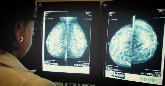 doctores, cirujano, cirujanos, doctoras, cirujano gastrointestinal, cirujano gastrointestinal y laparoscopia, cirujano general, laparoscopía, cirugia, hernias, hernias inguinales, vesícula, vesicula, hemorroides, fisuras anales, apendicectomía, apendicectomia, biopsias, cancer de mama, mastectomia, cáncer de mama, mastectomía, cirugía Conservadora de mama, cirugía Conservadora de mama, ganglio Centinela, seguimiento en cancer de mama, seguimiento en cáncer de mama, check up de la mujer, escleroterapia, úlceras, ulceras, heridas, apendicitis, piedras en vesicula, piedras en riñones, lipomas, doctores slp, cirujano slp, cirujanos slp, doctoras slp, cirujano gastrointestinal slp, cirujano gastrointestinal y laparoscopia slp, cirujano general slp, laparoscopía slp, cirugia slp, hernias slp, hernias inguinales slp, vesícula slp, vesicula slp, hemorroides slp, fisuras anales slp, apendicectomía slp, apendicectomia slp, biopsias slp, cancer de mama slp, mastectomia slp, cáncer de mama slp, mastectomía slp, cirugía Conservadora de mama slp, cirugía Conservadora de mama slp, ganglio Centinela slp, seguimiento en cancer de mama slp, seguimiento en cáncer de mama slp, check up de la mujer slp, escleroterapia slp, úlceras slp, ulceras slp, heridas slp, apendicitis slp, piedras en vesicula slp, piedras en riñones slp, lipomas slp, doctores san luis potosi, cirujano san luis potosi, cirujanos san luis potosi, doctoras san luis potosi, cirujano gastrointestinal san luis potosi, cirujano gastrointestinal y laparoscopia san luis potosi, cirujano general san luis potosi, laparoscopía san luis potosi, cirugia san luis potosi, hernias san luis potosi, hernias inguinales san luis potosi, vesícula san luis potosi, vesicula san luis potosi, hemorroides san luis potosi, fisuras anales san luis potosi, apendicectomía san luis potosi, apendicectomia san luis potosi, biopsias san luis potosi, cancer de mama san luis potosi, mastectomia san luis potosi, cáncer de mama san luis potosi, mastectomía san luis potosi, cirugía Conservadora de mama san luis potosi, cirugía Conservadora de mama san luis potosi, ganglio Centinela san luis potosi, seguimiento en cancer de mama san luis potosi, seguimiento en cáncer de mama san luis potosi, check up de la mujer san luis potosi, escleroterapia san luis potosi, úlceras san luis potosi, ulceras san luis potosi, heridas san luis potosi, apendicitis san luis potosi, piedras en vesicula san luis potosi, piedras en riñones san luis potosi, lipomas san luis potosi, doctores san luis potosí, cirujano san luis potosí, cirujanos san luis potosí, doctoras san luis potosí, cirujano gastrointestinal san luis potosí, cirujano gastrointestinal y laparoscopia san luis potosí, cirujano general san luis potosí, laparoscopía san luis potosí, cirugia, hernias san luis potosí, hernias inguinales san luis potosí, vesícula san luis potosí, vesicula san luis potosí, hemorroides san luis potosí, fisuras anales san luis potosí, apendicectomía san luis potosí, apendicectomia san luis potosí, biopsias san luis potosí, cancer de mama san luis potosí, mastectomia san luis potosí, cáncer de mama san luis potosí, mastectomía san luis potosí, cirugía Conservadora de mama san luis potosí, cirugía Conservadora de mama san luis potosí, ganglio Centinela san luis potosí, seguimiento en cancer de mama san luis potosí, seguimiento en cáncer de mama san luis potosí, check up de la mujer san luis potosí, escleroterapia san luis potosí, úlceras, ulceras san luis potosí, heridas san luis potosí, apendicitis san luis potosí, piedras en vesicula san luis potosí, piedras en riñones san luis potosí, lipomas san luis potosí,