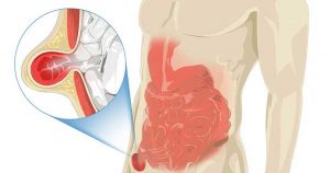 doctores, cirujano, cirujanos, doctoras, cirujano gastrointestinal, cirujano gastrointestinal y laparoscopia, cirujano general, laparoscopía, cirugia, hernias, hernias inguinales, vesícula, vesicula, hemorroides, fisuras anales, apendicectomía, apendicectomia, biopsias, cancer de mama, mastectomia, cáncer de mama, mastectomía, cirugía Conservadora de mama, cirugía Conservadora de mama, ganglio Centinela, seguimiento en cancer de mama, seguimiento en cáncer de mama, check up de la mujer, escleroterapia, úlceras, ulceras, heridas, apendicitis, piedras en vesicula, piedras en riñones, lipomas, doctores slp, cirujano slp, cirujanos slp, doctoras slp, cirujano gastrointestinal slp, cirujano gastrointestinal y laparoscopia slp, cirujano general slp, laparoscopía slp, cirugia slp, hernias slp, hernias inguinales slp, vesícula slp, vesicula slp, hemorroides slp, fisuras anales slp, apendicectomía slp, apendicectomia slp, biopsias slp, cancer de mama slp, mastectomia slp, cáncer de mama slp, mastectomía slp, cirugía Conservadora de mama slp, cirugía Conservadora de mama slp, ganglio Centinela slp, seguimiento en cancer de mama slp, seguimiento en cáncer de mama slp, check up de la mujer slp, escleroterapia slp, úlceras slp, ulceras slp, heridas slp, apendicitis slp, piedras en vesicula slp, piedras en riñones slp, lipomas slp, doctores san luis potosi, cirujano san luis potosi, cirujanos san luis potosi, doctoras san luis potosi, cirujano gastrointestinal san luis potosi, cirujano gastrointestinal y laparoscopia san luis potosi, cirujano general san luis potosi, laparoscopía san luis potosi, cirugia san luis potosi, hernias san luis potosi, hernias inguinales san luis potosi, vesícula san luis potosi, vesicula san luis potosi, hemorroides san luis potosi, fisuras anales san luis potosi, apendicectomía san luis potosi, apendicectomia san luis potosi, biopsias san luis potosi, cancer de mama san luis potosi, mastectomia san luis potosi, cáncer de mama san luis potosi, mastectomía san luis potosi, cirugía Conservadora de mama san luis potosi, cirugía Conservadora de mama san luis potosi, ganglio Centinela san luis potosi, seguimiento en cancer de mama san luis potosi, seguimiento en cáncer de mama san luis potosi, check up de la mujer san luis potosi, escleroterapia san luis potosi, úlceras san luis potosi, ulceras san luis potosi, heridas san luis potosi, apendicitis san luis potosi, piedras en vesicula san luis potosi, piedras en riñones san luis potosi, lipomas san luis potosi, doctores san luis potosí, cirujano san luis potosí, cirujanos san luis potosí, doctoras san luis potosí, cirujano gastrointestinal san luis potosí, cirujano gastrointestinal y laparoscopia san luis potosí, cirujano general san luis potosí, laparoscopía san luis potosí, cirugia, hernias san luis potosí, hernias inguinales san luis potosí, vesícula san luis potosí, vesicula san luis potosí, hemorroides san luis potosí, fisuras anales san luis potosí, apendicectomía san luis potosí, apendicectomia san luis potosí, biopsias san luis potosí, cancer de mama san luis potosí, mastectomia san luis potosí, cáncer de mama san luis potosí, mastectomía san luis potosí, cirugía Conservadora de mama san luis potosí, cirugía Conservadora de mama san luis potosí, ganglio Centinela san luis potosí, seguimiento en cancer de mama san luis potosí, seguimiento en cáncer de mama san luis potosí, check up de la mujer san luis potosí, escleroterapia san luis potosí, úlceras, ulceras san luis potosí, heridas san luis potosí, apendicitis san luis potosí, piedras en vesicula san luis potosí, piedras en riñones san luis potosí, lipomas san luis potosí,