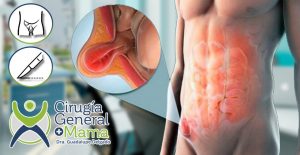 doctores, cirujano, cirujanos, doctoras, cirujano gastrointestinal, cirujano gastrointestinal y laparoscopia, cirujano general, laparoscopía, cirugia, hernias, hernias inguinales, vesícula, vesicula, hemorroides, fisuras anales, apendicectomía, apendicectomia, biopsias, cancer de mama, mastectomia, cáncer de mama, mastectomía, cirugía Conservadora de mama, cirugía Conservadora de mama, ganglio Centinela, seguimiento en cancer de mama, seguimiento en cáncer de mama, check up de la mujer, escleroterapia, úlceras, ulceras, heridas, apendicitis, piedras en vesicula, piedras en riñones, lipomas, doctores slp, cirujano slp, cirujanos slp, doctoras slp, cirujano gastrointestinal slp, cirujano gastrointestinal y laparoscopia slp, cirujano general slp, laparoscopía slp, cirugia slp, hernias slp, hernias inguinales slp, vesícula slp, vesicula slp, hemorroides slp, fisuras anales slp, apendicectomía slp, apendicectomia slp, biopsias slp, cancer de mama slp, mastectomia slp, cáncer de mama slp, mastectomía slp, cirugía Conservadora de mama slp, cirugía Conservadora de mama slp, ganglio Centinela slp, seguimiento en cancer de mama slp, seguimiento en cáncer de mama slp, check up de la mujer slp, escleroterapia slp, úlceras slp, ulceras slp, heridas slp, apendicitis slp, piedras en vesicula slp, piedras en riñones slp, lipomas slp, doctores san luis potosi, cirujano san luis potosi, cirujanos san luis potosi, doctoras san luis potosi, cirujano gastrointestinal san luis potosi, cirujano gastrointestinal y laparoscopia san luis potosi, cirujano general san luis potosi, laparoscopía san luis potosi, cirugia san luis potosi, hernias san luis potosi, hernias inguinales san luis potosi, vesícula san luis potosi, vesicula san luis potosi, hemorroides san luis potosi, fisuras anales san luis potosi, apendicectomía san luis potosi, apendicectomia san luis potosi, biopsias san luis potosi, cancer de mama san luis potosi, mastectomia san luis potosi, cáncer de mama san luis potosi, mastectomía san luis potosi, cirugía Conservadora de mama san luis potosi, cirugía Conservadora de mama san luis potosi, ganglio Centinela san luis potosi, seguimiento en cancer de mama san luis potosi, seguimiento en cáncer de mama san luis potosi, check up de la mujer san luis potosi, escleroterapia san luis potosi, úlceras san luis potosi, ulceras san luis potosi, heridas san luis potosi, apendicitis san luis potosi, piedras en vesicula san luis potosi, piedras en riñones san luis potosi, lipomas san luis potosi, doctores san luis potosí, cirujano san luis potosí, cirujanos san luis potosí, doctoras san luis potosí, cirujano gastrointestinal san luis potosí, cirujano gastrointestinal y laparoscopia san luis potosí, cirujano general san luis potosí, laparoscopía san luis potosí, cirugia, hernias san luis potosí, hernias inguinales san luis potosí, vesícula san luis potosí, vesicula san luis potosí, hemorroides san luis potosí, fisuras anales san luis potosí, apendicectomía san luis potosí, apendicectomia san luis potosí, biopsias san luis potosí, cancer de mama san luis potosí, mastectomia san luis potosí, cáncer de mama san luis potosí, mastectomía san luis potosí, cirugía Conservadora de mama san luis potosí, cirugía Conservadora de mama san luis potosí, ganglio Centinela san luis potosí, seguimiento en cancer de mama san luis potosí, seguimiento en cáncer de mama san luis potosí, check up de la mujer san luis potosí, escleroterapia san luis potosí, úlceras, ulceras san luis potosí, heridas san luis potosí, apendicitis san luis potosí, piedras en vesicula san luis potosí, piedras en riñones san luis potosí, lipomas san luis potosí,