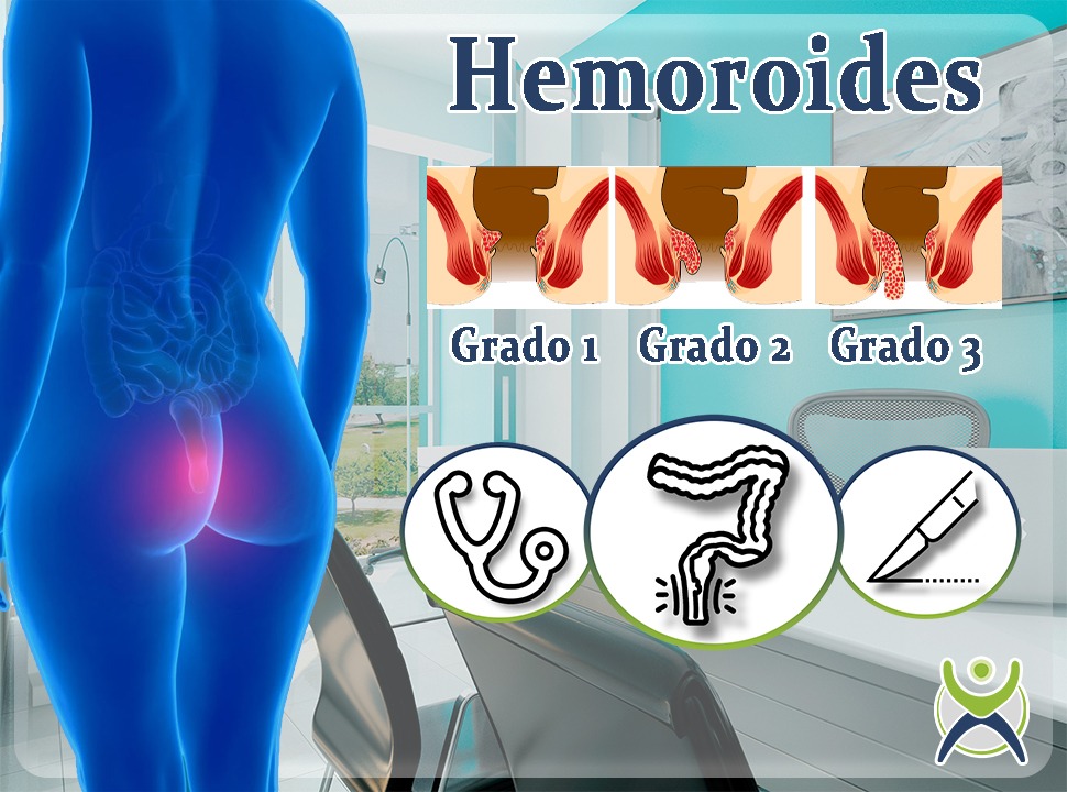 doctores, cirujano, cirujanos, doctoras, cirujano gastrointestinal, cirujano gastrointestinal y laparoscopia, cirujano general, laparoscopía, cirugia, hernias, hernias inguinales, vesícula, vesicula, hemorroides, fisuras anales, apendicectomía, apendicectomia, biopsias, cancer de mama, mastectomia, cáncer de mama, mastectomía, cirugía Conservadora de mama, cirugía Conservadora de mama, ganglio Centinela, seguimiento en cancer de mama, seguimiento en cáncer de mama, check up de la mujer, escleroterapia, úlceras, ulceras, heridas, apendicitis, piedras en vesicula, piedras en riñones, lipomas, doctores slp, cirujano slp, cirujanos slp, doctoras slp, cirujano gastrointestinal slp, cirujano gastrointestinal y laparoscopia slp, cirujano general slp, laparoscopía slp, cirugia slp, hernias slp, hernias inguinales slp, vesícula slp, vesicula slp, hemorroides slp, fisuras anales slp, apendicectomía slp, apendicectomia slp, biopsias slp, cancer de mama slp, mastectomia slp, cáncer de mama slp, mastectomía slp, cirugía Conservadora de mama slp, cirugía Conservadora de mama slp, ganglio Centinela slp, seguimiento en cancer de mama slp, seguimiento en cáncer de mama slp, check up de la mujer slp, escleroterapia slp, úlceras slp, ulceras slp, heridas slp, apendicitis slp, piedras en vesicula slp, piedras en riñones slp, lipomas slp, doctores san luis potosi, cirujano san luis potosi, cirujanos san luis potosi, doctoras san luis potosi, cirujano gastrointestinal san luis potosi, cirujano gastrointestinal y laparoscopia san luis potosi, cirujano general san luis potosi, laparoscopía san luis potosi, cirugia san luis potosi, hernias san luis potosi, hernias inguinales san luis potosi, vesícula san luis potosi, vesicula san luis potosi, hemorroides san luis potosi, fisuras anales san luis potosi, apendicectomía san luis potosi, apendicectomia san luis potosi, biopsias san luis potosi, cancer de mama san luis potosi, mastectomia san luis potosi, cáncer de mama san luis potosi, mastectomía san luis potosi, cirugía Conservadora de mama san luis potosi, cirugía Conservadora de mama san luis potosi, ganglio Centinela san luis potosi, seguimiento en cancer de mama san luis potosi, seguimiento en cáncer de mama san luis potosi, check up de la mujer san luis potosi, escleroterapia san luis potosi, úlceras san luis potosi, ulceras san luis potosi, heridas san luis potosi, apendicitis san luis potosi, piedras en vesicula san luis potosi, piedras en riñones san luis potosi, lipomas san luis potosi, doctores san luis potosí, cirujano san luis potosí, cirujanos san luis potosí, doctoras san luis potosí, cirujano gastrointestinal san luis potosí, cirujano gastrointestinal y laparoscopia san luis potosí, cirujano general san luis potosí, laparoscopía san luis potosí, cirugia, hernias san luis potosí, hernias inguinales san luis potosí, vesícula san luis potosí, vesicula san luis potosí, hemorroides san luis potosí, fisuras anales san luis potosí, apendicectomía san luis potosí, apendicectomia san luis potosí, biopsias san luis potosí, cancer de mama san luis potosí, mastectomia san luis potosí, cáncer de mama san luis potosí, mastectomía san luis potosí, cirugía Conservadora de mama san luis potosí, cirugía Conservadora de mama san luis potosí, ganglio Centinela san luis potosí, seguimiento en cancer de mama san luis potosí, seguimiento en cáncer de mama san luis potosí, check up de la mujer san luis potosí, escleroterapia san luis potosí, úlceras, ulceras san luis potosí, heridas san luis potosí, apendicitis san luis potosí, piedras en vesicula san luis potosí, piedras en riñones san luis potosí, lipomas san luis potosí,